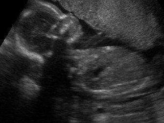 This Utah OBGYN Aborted a 19 Week Baby. Here’s Her Bizarre Justification: